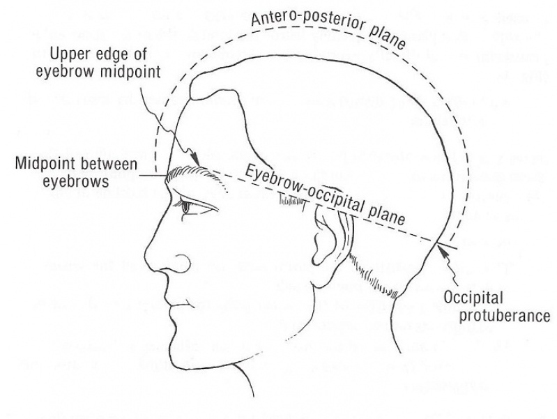 Craniopuntura para Estresse em Sp Saúde - Tratamento para Dor com Craniopuntura