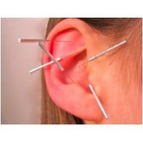 acupuntura auricular em sp Itaim Bibi