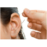 acupuntura na orelha para emagrecer clínica Parque Ibirapuera