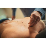 contato de clínica de acupuntura para tendinite Ibirapuera