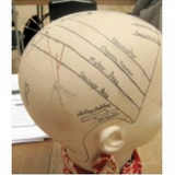 craniopuntura para sinusite Brooklin