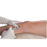 injeção com ácido hialurônico no joelho clínica Moema