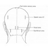 onde encontrar craniopuntura para dor de cabeça frontal Cursino